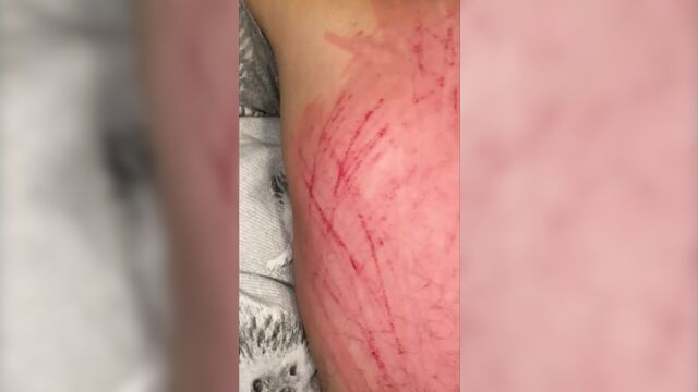 Почесывание спины, часть 2, длинные натуральные ногти