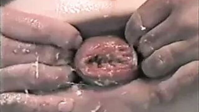 Огромный анальный фистинг