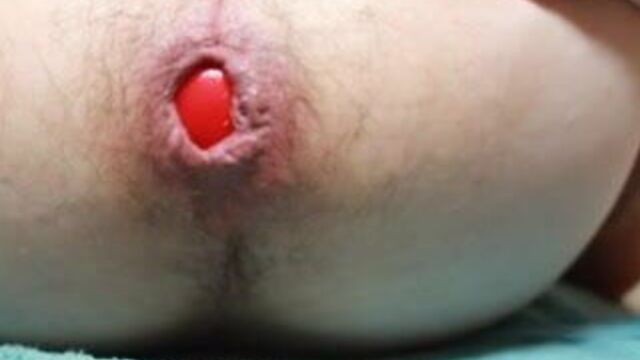 Игрушка и антистрессовый шарик в заднице