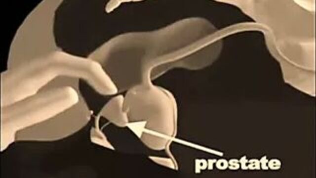 Техники массажа простаты