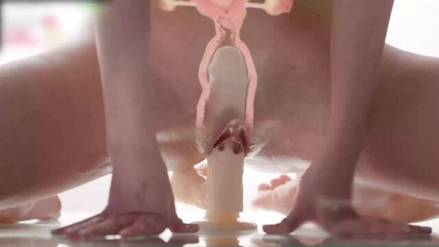 Рентгеновское введение